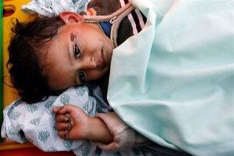 A Palestinian child wounded in the Israeli offensive arrives at the Rafah border crossing between the Gaza Strip and Egypt.(AFP/Khaled Desouki)