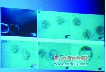 Human embryos are seen developed outside the human body, shown in this photo released on Monday, February 2, 2009 during a press conference arranged by Shandong Stem Cell Engineering Research Center. The center announced that a research team, led by professor Li Jianyuan, successfully cloned five human blastulas in line with international standards. The cloning of human blastulas is a useful technique for the medical treatment of patients with Parkinson disease. The web edition of periodical "Cloning and Stem Cells" reported the scientific achievement on January 27, 2009. [Photo: nddaily.com]