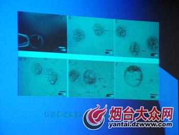 A Research team at Shandong Stem Cell Engineering Research Center has successfully cloned five human blastulas from 135 eggs.