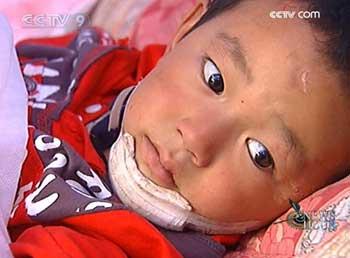 This was Zhang Xiaocong one year ago. He was too young to understand what had happened to his parents. He was brought to the temporary ward, with a fractured leg.