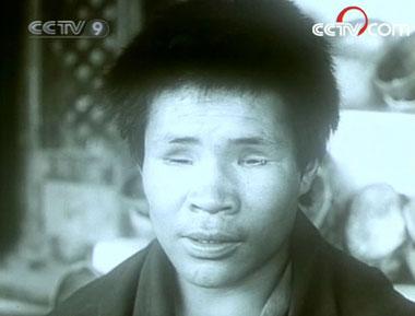 Serf with eyes gouged by owners