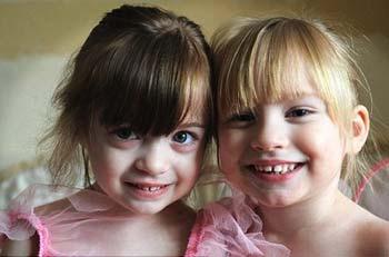 Rare condition: Three-year-old Katie (left) has had a transplant and twin sister Lauren (right) needs one too. [Agencies]